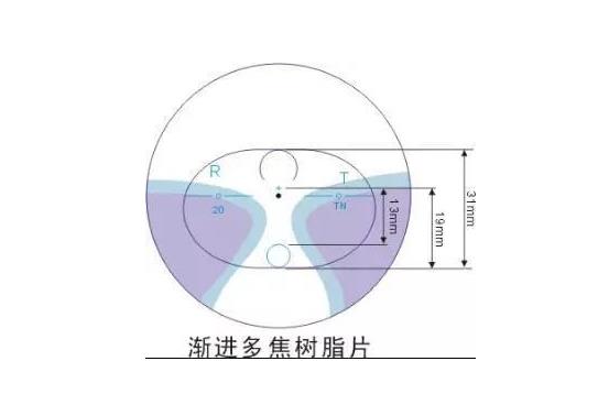 美麗島漸進(jìn)多焦鏡適合的人群，需要注意的事項(xiàng)